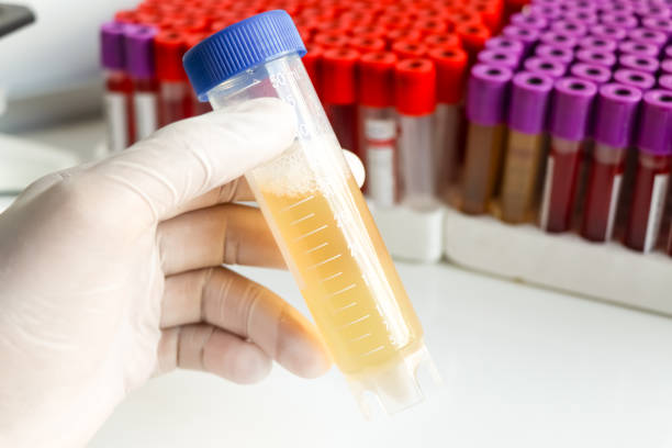 Understanding Uric Acid and Gout
