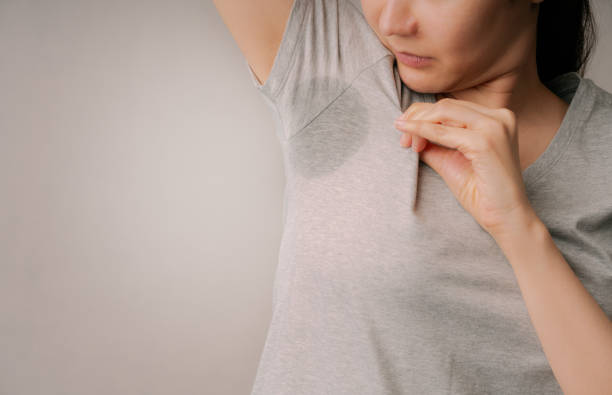 Tips for Managing Excessive Sweating