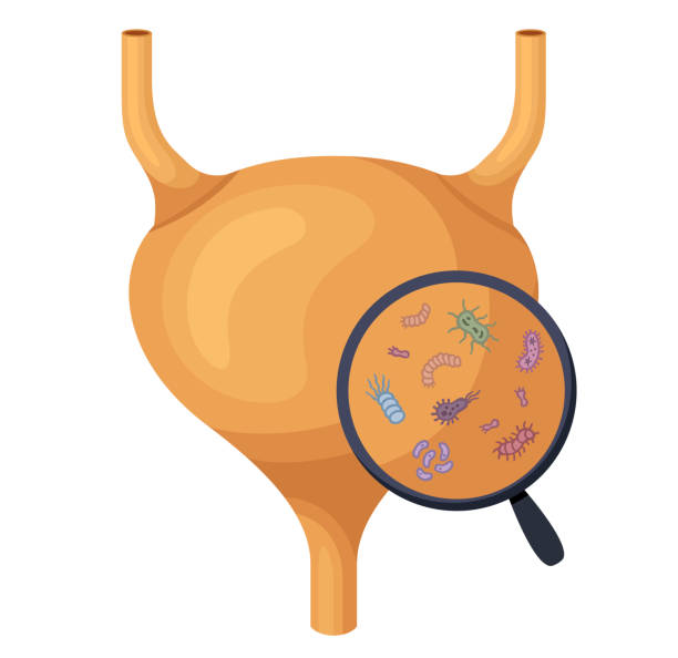Understanding UTIs