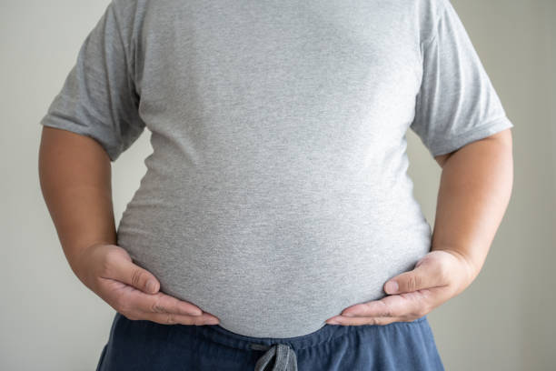 Prevalence and Causes of Obesity