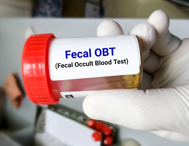 When a person suspects that they have colon cancer, the first step is to get diagnostic testing to confirm the diagnosis and establish the stage of the cancer.