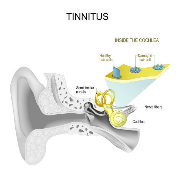 Understanding Tinnitus and Its Causes
