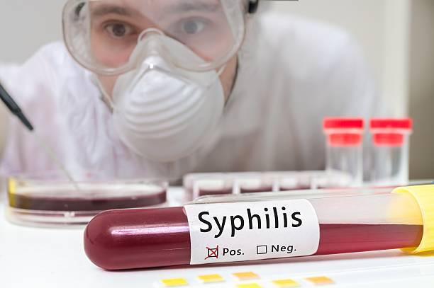 Clinical Manifestations and Stages of Syphilis