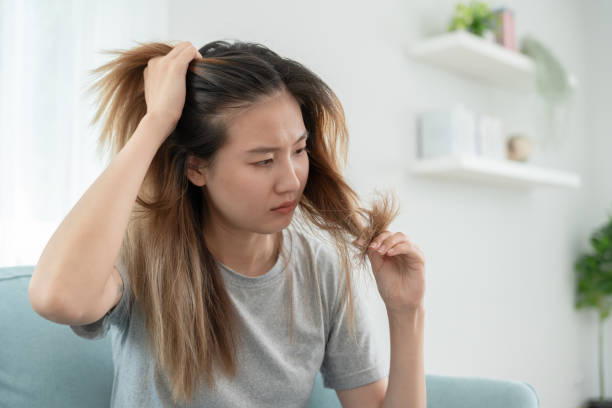 Lifestyle Changes to Promote Hair Growth and help prevent hair loss naturally