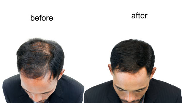 Herbal Supplements that help with hair loss naturally