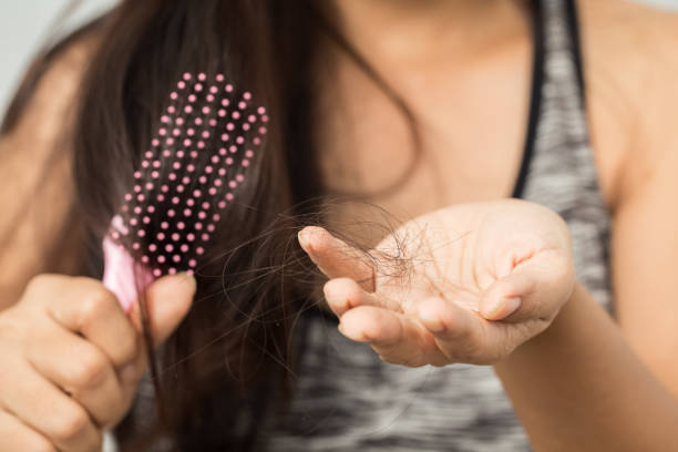 Understanding Hair Loss and Its Causes