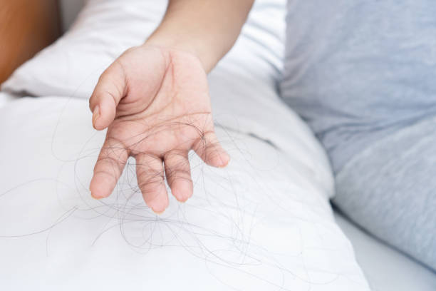 Tips for Preventing Hair Loss While Using Supplements