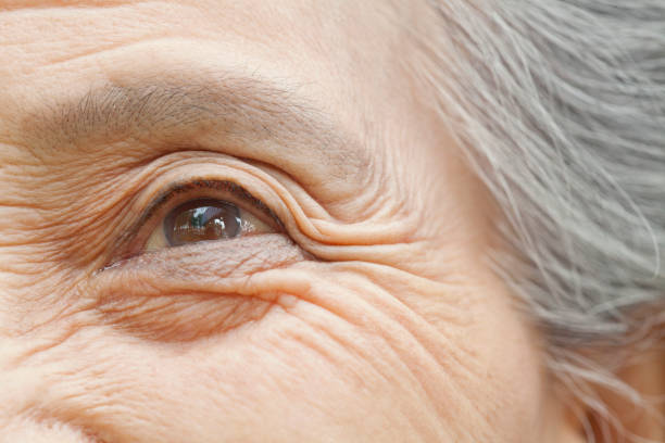 Common Age-Related Eye Conditions