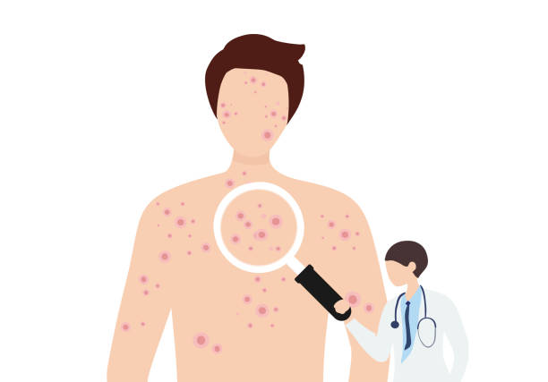 This section will look at the most prevalent signs and effects of psoriasis.