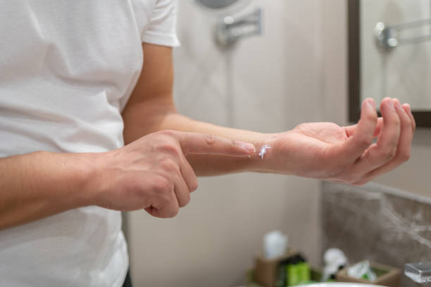 Natural Treatments for Psoriasis