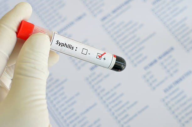 Syphilis is diagnosed with a blood test that detects antibodies to the germs that cause the infection.