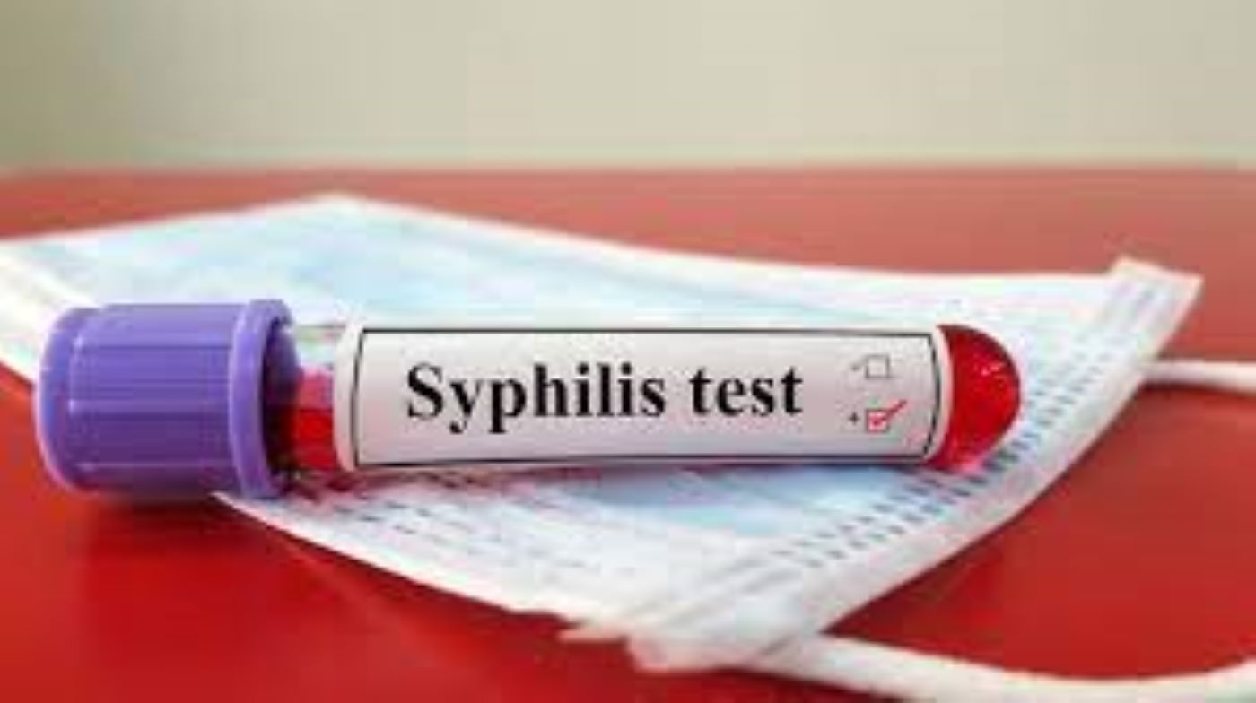 Breaking The Stigma: Syphilis Without Hiv - Discovery Body