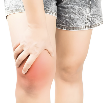 Understanding the Causes of Swollen Knees after Running