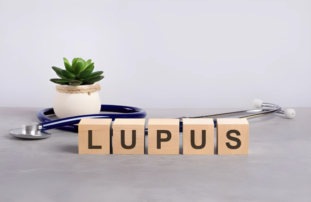 Lupus: Unraveling its Effects on the Body