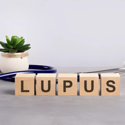 Lupus: Unraveling its Effects on the Body