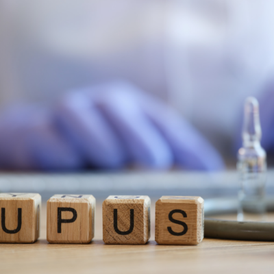 Avoid These Common Mistakes When Living with Lupus