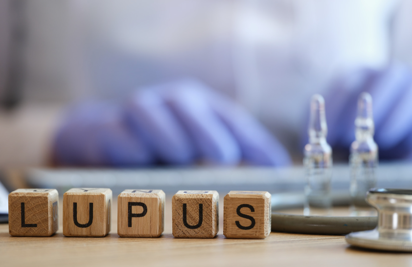 Avoid These Common Mistakes When Living with Lupus