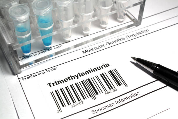 Metabolic problems can also cause poor body odor. These illnesses impair the body's capacity to break down specific chemicals, causing the creation of odorous molecules. One such condition is trimethylaminuria (TMAU), often known as fish odor syndrome.