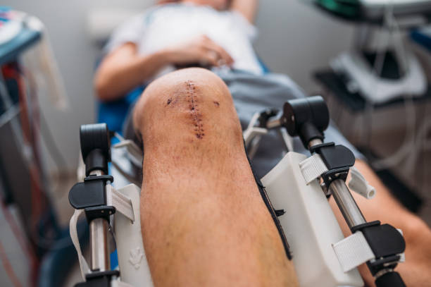 Non-surgical treatments, including injections and minimally invasive procedures, may be useful for patients with mild to moderate osteoarthritis knee discomfort.