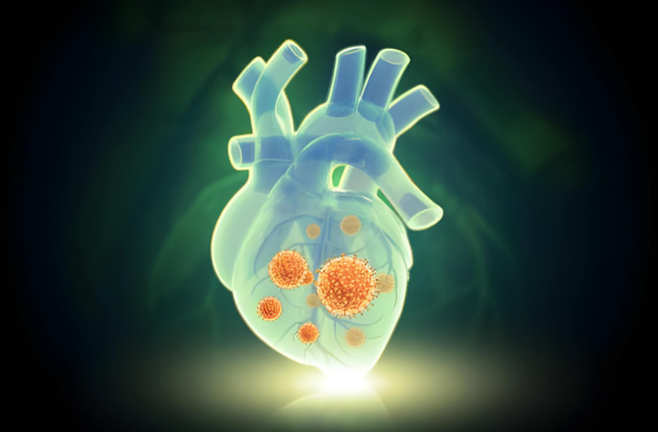 A heart infection occurs when microorganisms or other irritants enter your heart which can cause heart health issues.
