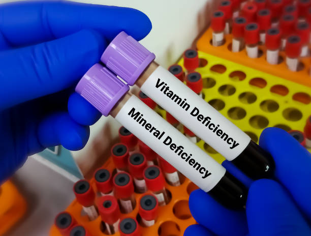 Common Symptoms of Vitamin Deficiencies