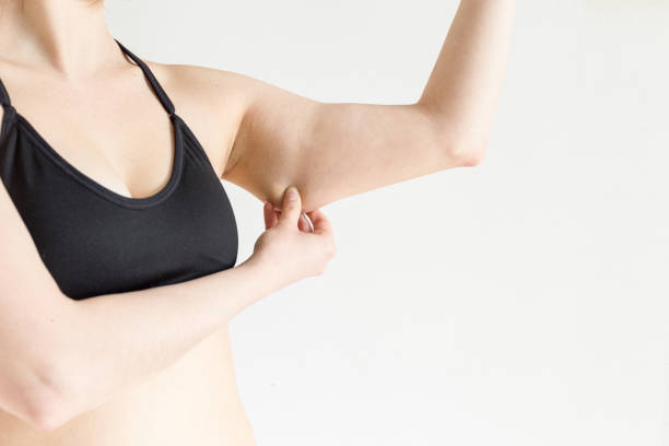 Common Causes of Sagging Skin