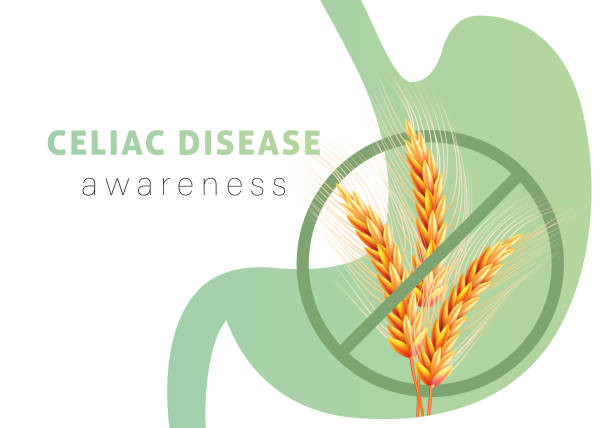 Certain medical diseases might impair the absorption of vitamin D in the body, resulting in insufficiency. Celiac disease, an autoimmune ailment damaging the small intestine, can lead to deficiencies, including a deficiency in vitamin D.