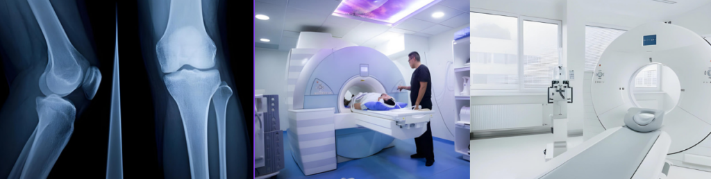 Imaging Tests for Rheumatoid Arthritis to help diagnose