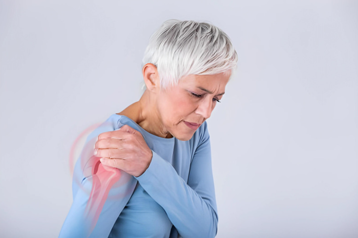 Rheumatoid arthritis (RA) is characterized by inflammation of the joints, which leads to pain, swelling, stiffness, and eventual joint damage.