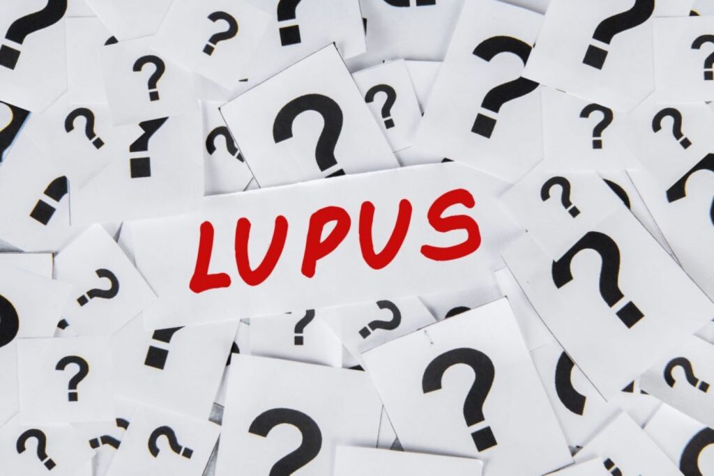 The Dangers of Untreated Lupus