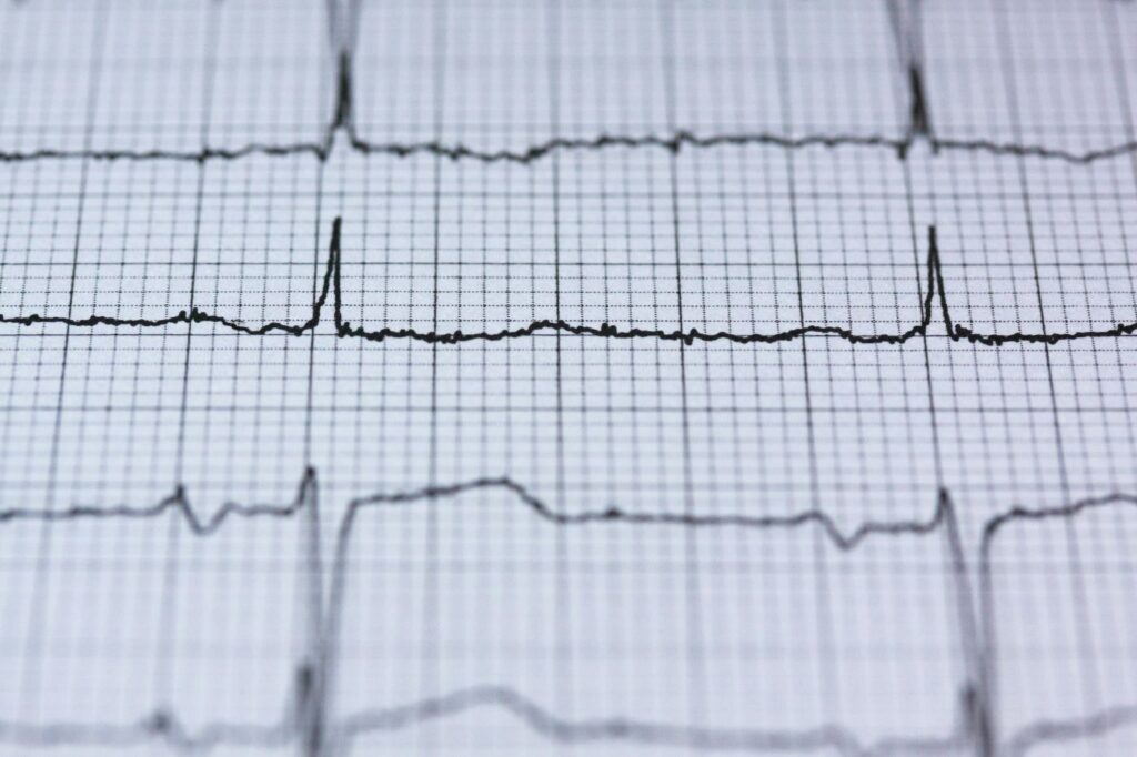 Understanding What Heart Palpitations Might Indicate