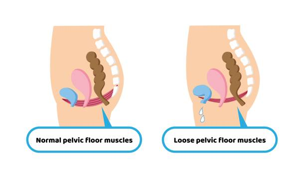 Understanding Kegel Exercises