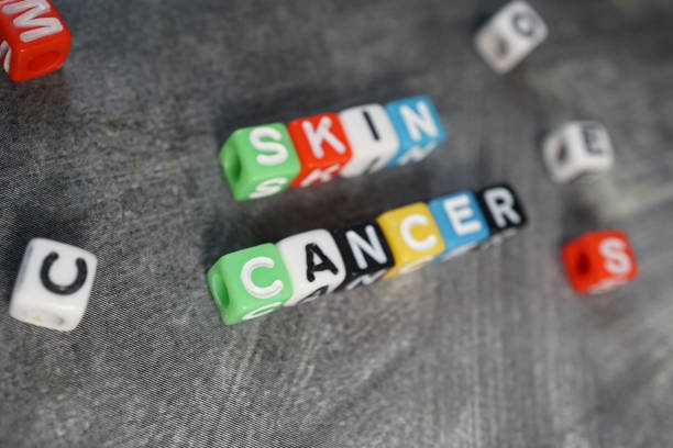 The most prevalent kinds are basal cell carcinoma, squamous cell carcinoma, and melanoma.