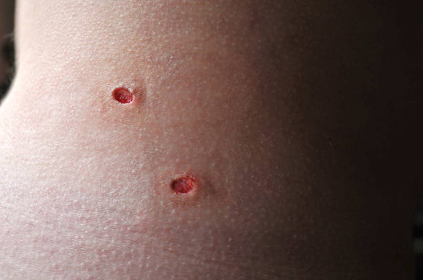 Skin tags are generally innocuous and pose no significant medical risks. They may, however, cause discomfort, bleeding, or infection if they are placed in frequently touched or scratched regions.