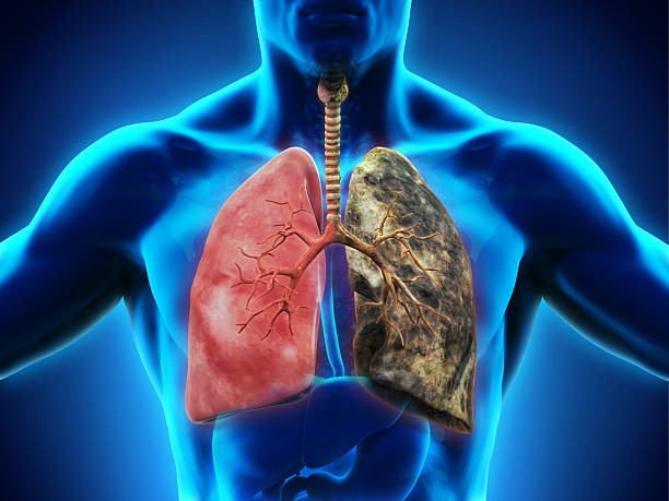 Tobacco usage has been related to a variety of major health issues that can arise over time