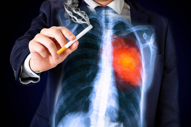 Tobacco use can have a substantial impact on men's health