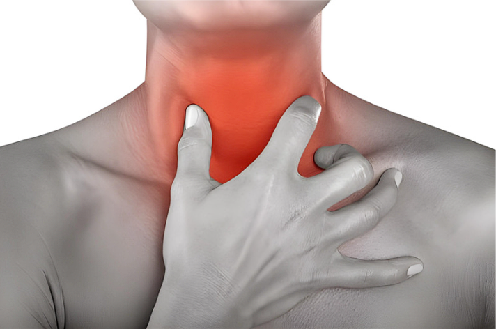 Ruptured plaques in the neck arteries represent a considerable risk, especially because they can cause a stroke