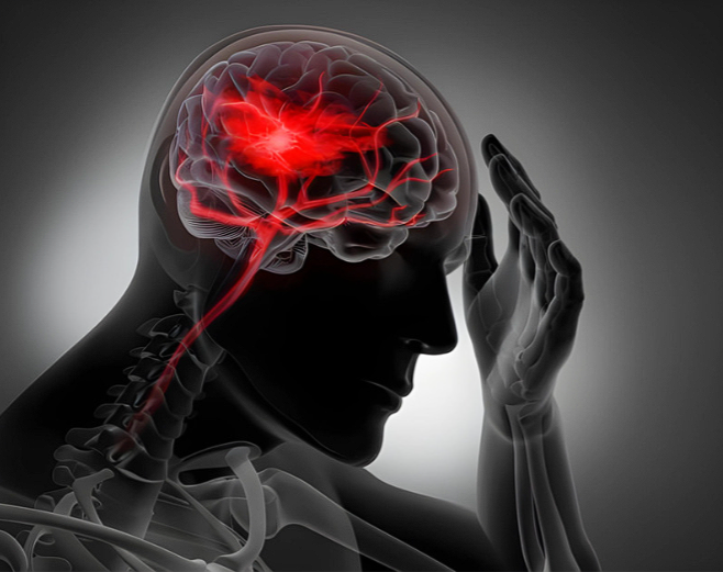 Blood clot blockage in the neck arteries can lead to severe complications due to reduced blood flow to the brain.