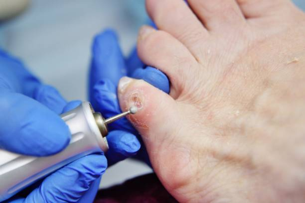 Surgical techniques, non-surgical therapy, developing medicines, and clinical trials are among the most prevalent alternatives for treating skin cancer