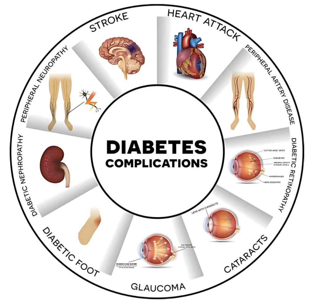 Complications of Diabetes