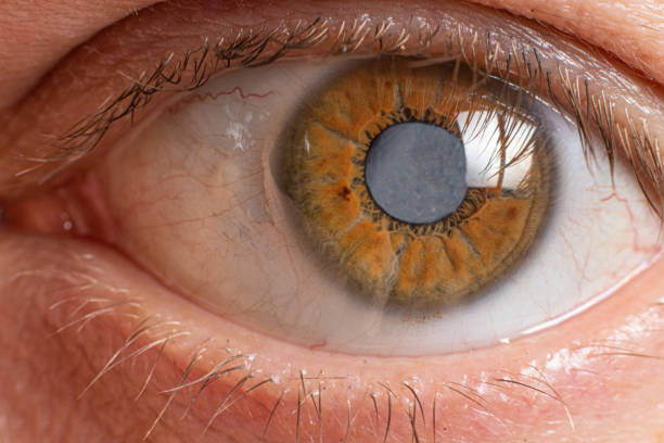 Common Symptoms of Glaucoma