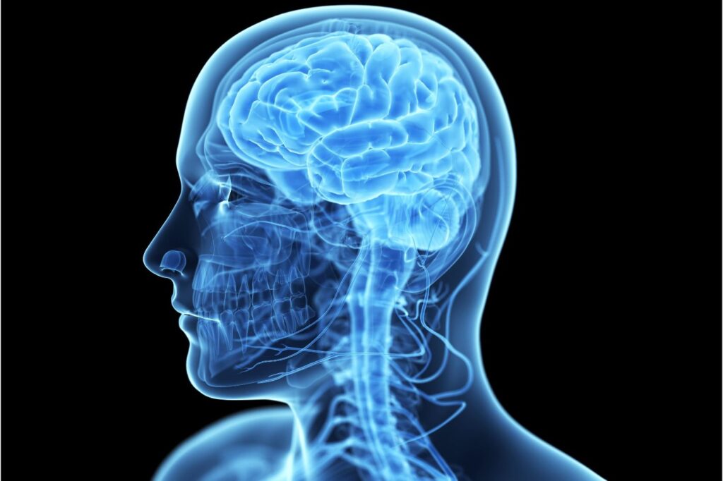 How Strokes Impact the Brain