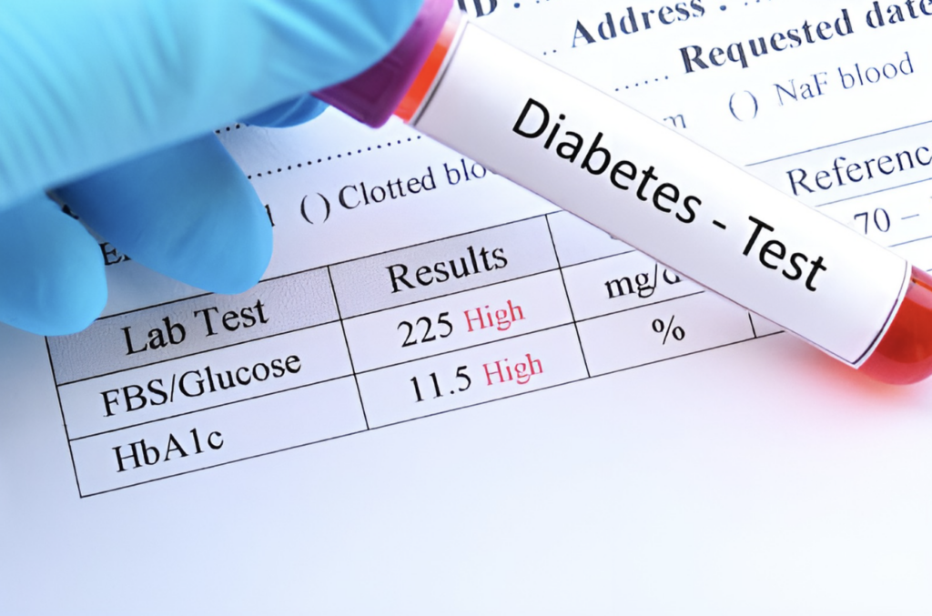 tests to diagnose diabetes