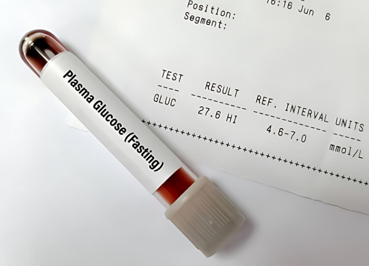 The Fasting Plasma Glucose (FPG) test is a basic diagnostic tool used to determine blood sugar levels following an overnight fast of at least eight hours.