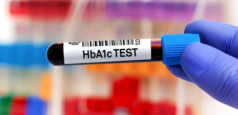 The A1C test, commonly known as the glycated hemoglobin test, is an important diagnostic tool in the treatment and diagnosis of diabetes