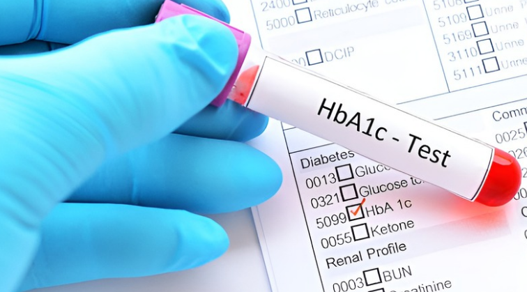A1C Test (Hemoglobin A1C or HbA1c)